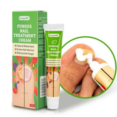 Fungus Nail Treatment Cream - 20g