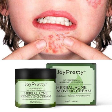 herbal acne removing cream 50g anti inflammation