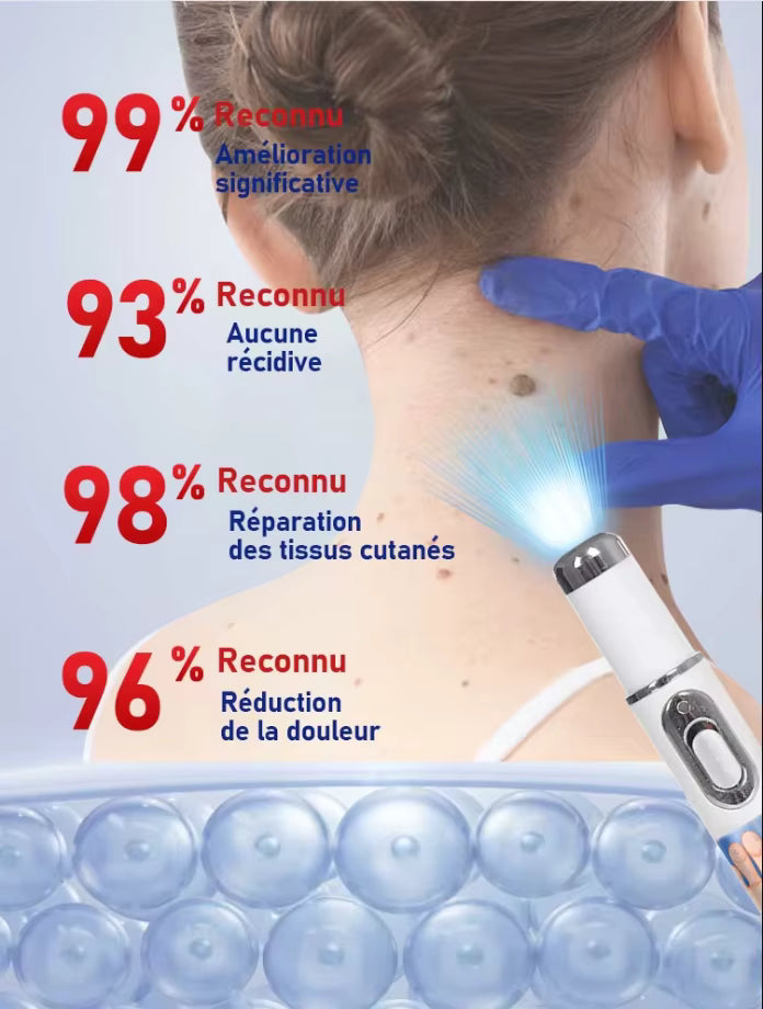 Fast Acting 7 Days Verruca Treatment & Wart Remover Pen — Face, Hand & Foot