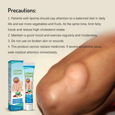 Lipoma Cream, Contains Ginger And Castor Oil, Body Care Cream For Moisturizing And Nourishing Skin Lip Balm Bulk Moisturizer Face Cream