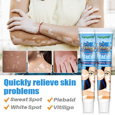 Vitiligo Ointment Psoriasis Mycosis Leukoplakia Antibacterial Anti-itch Relief Pain Treatment Cream 20g