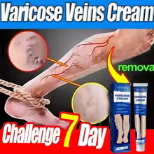 Varicose Vein & Spider Vein Relief Cream 20g