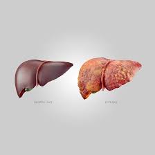 Liver Care