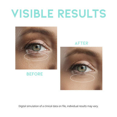 Wrinkle lift eye serum clinically proven 30g