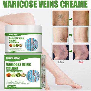 Varicose Vein Treatments Cream 30g Effective Relieve Legs Dilated Vasculitis Phlebitis Natural Formula Ointment For Varicose Veins