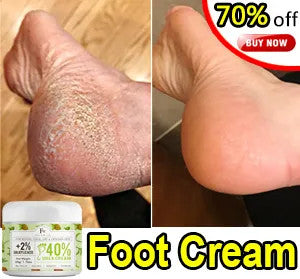 Urea Anti Drying Foot Cream Crack Heel Cream Removal Feet Calluses Dead Skin Repair Crack Skin Moisturizing Hydration For Foot