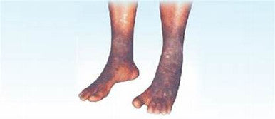 lippu ointment 75g 1