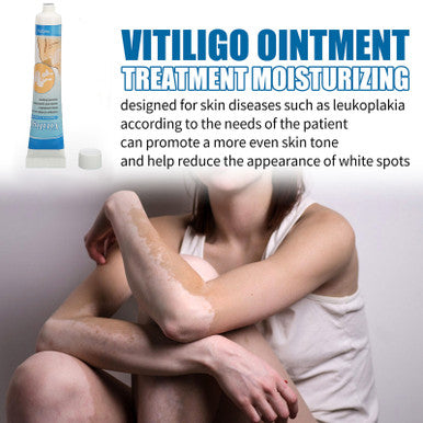 Vitiligo Cream Herbal Extract White Spots Vitiligo Treatment Ointment OMC