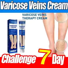 vericous veins